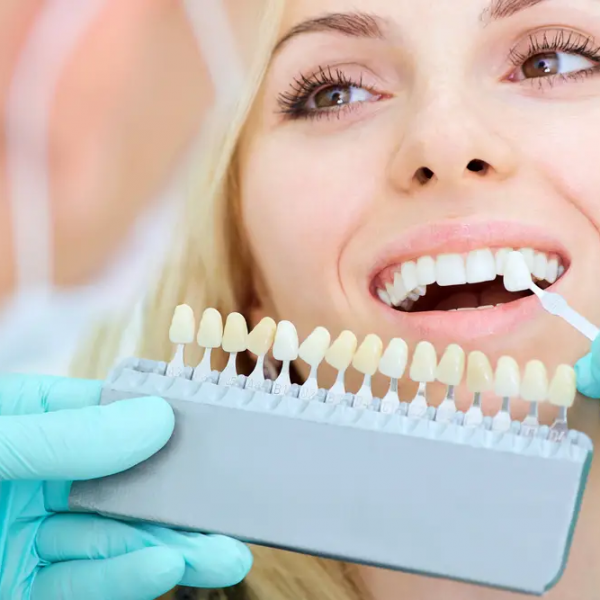 Top Considerations Before Getting Teeth Implants